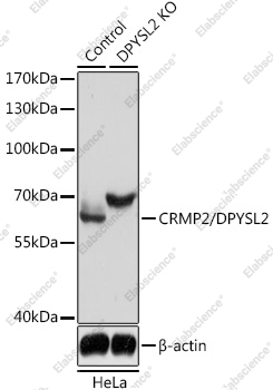 Вестерн-блоттинг, CRMP2/DPYSL2, клетки HeLa