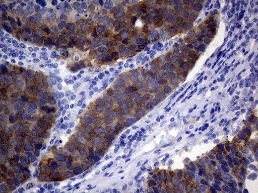 Валидация AssayVector ARM1158(441)