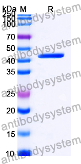 YHD89802, SDS-PAGE