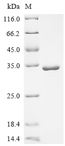 SDS-PAGE
