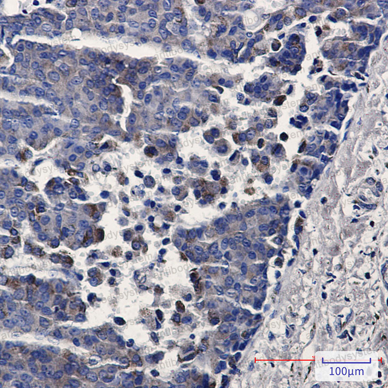 Валидация AntibodySystem RHJ67501