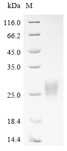 SDS-PAGE