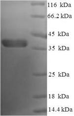 SDS-PAGE