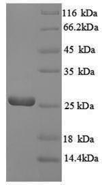 SDS-PAGE