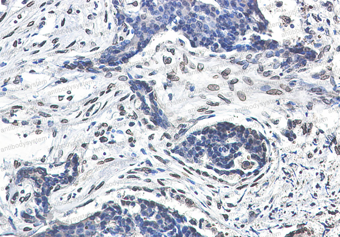 Валидация AntibodySystem RHB98202