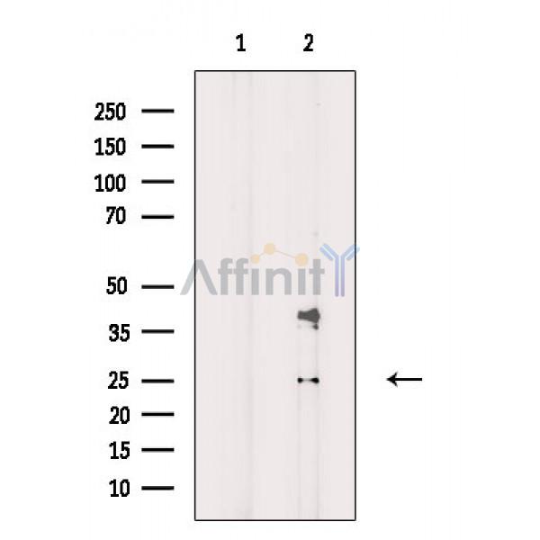 Валидация Affinity AF6741 - 3991