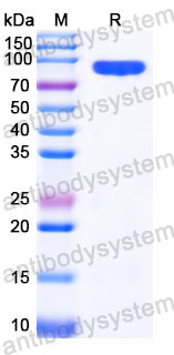 EHC31601, SDS-PAGE