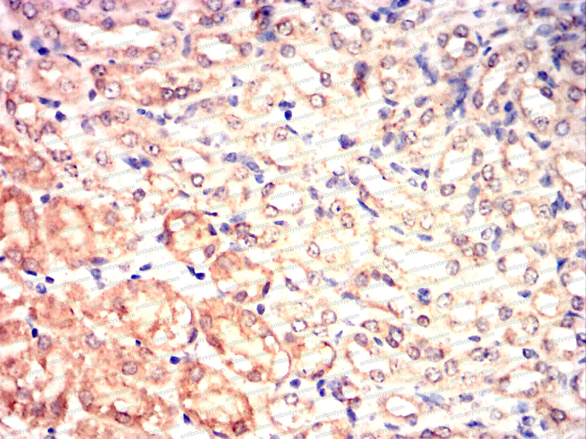 Валидация AntibodySystem RHA16101 (48)