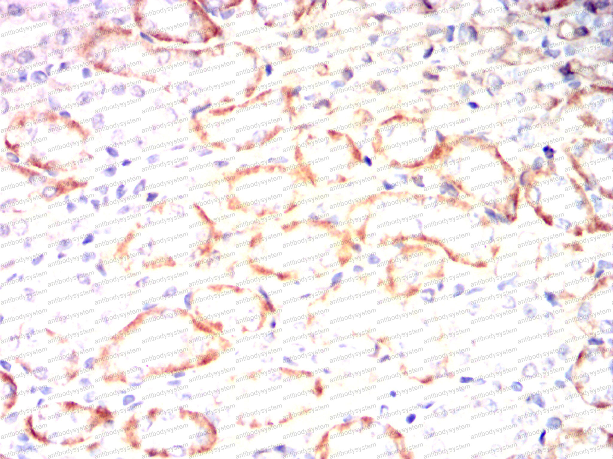 Валидация AntibodySystem RHC33705