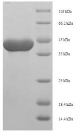 SDS-PAGE