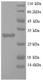 SDS-PAGE