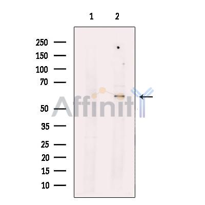 Валидация Affinity DF9092 - 21381