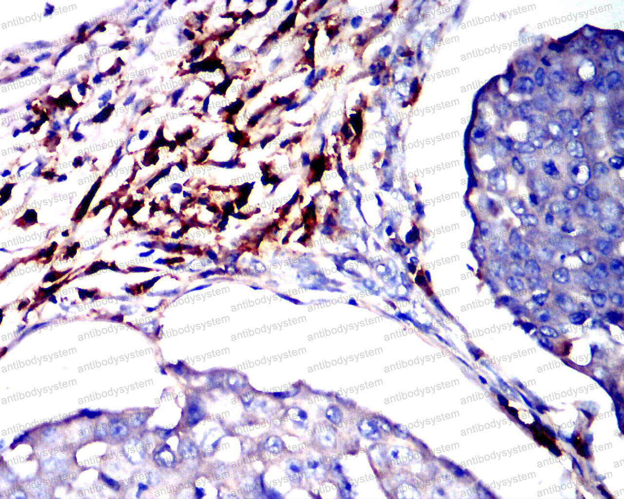 Валидация AntibodySystem RHD80809 (1832)