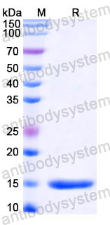 Валидация SDS-PAGE - AntibodySystem RVV00804