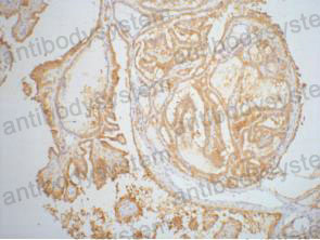 Валидация AntibodySystem RHD27111