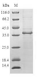 SDS-PAGE