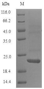 SDS-PAGE