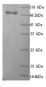 SDS-PAGE