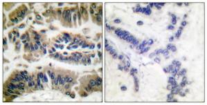 Валидация AssayVector ARM1017(51)