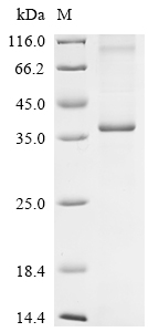 SDS-PAGE