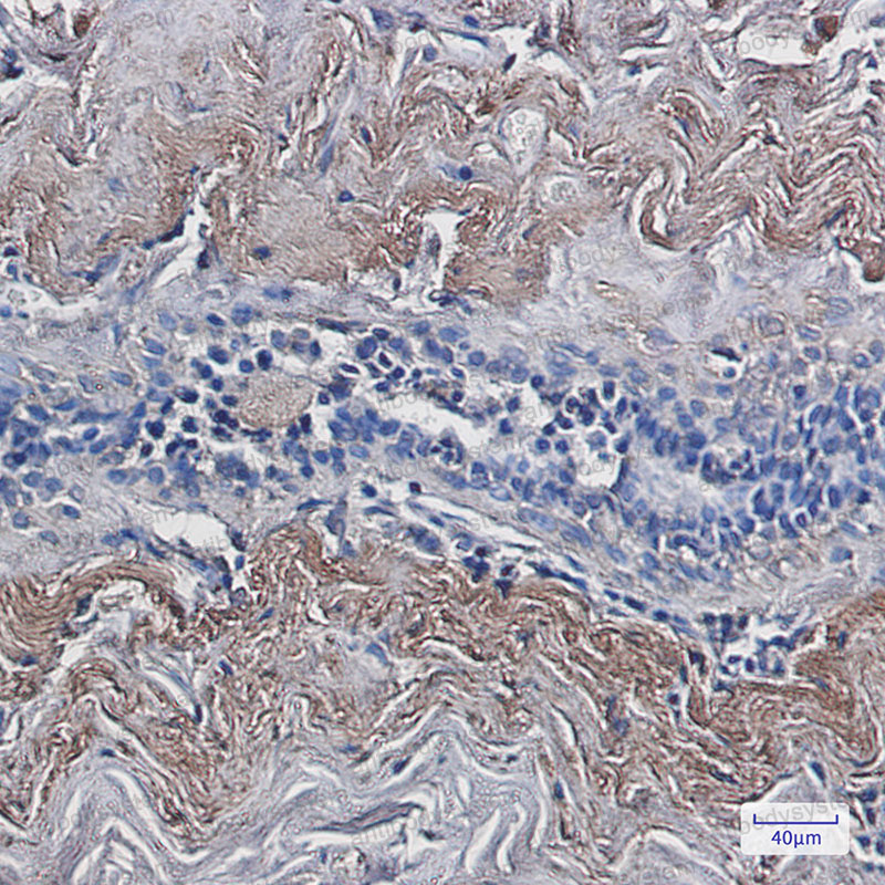 Валидация AntibodySystem RHA66201