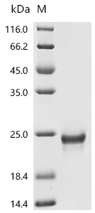 SDS-PAGE