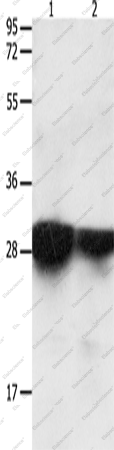 Вестерн-блоттинг, 14-3-3 epsilon, ткань злокачественной глиомы головного мозга и гортанной карциномы человека
