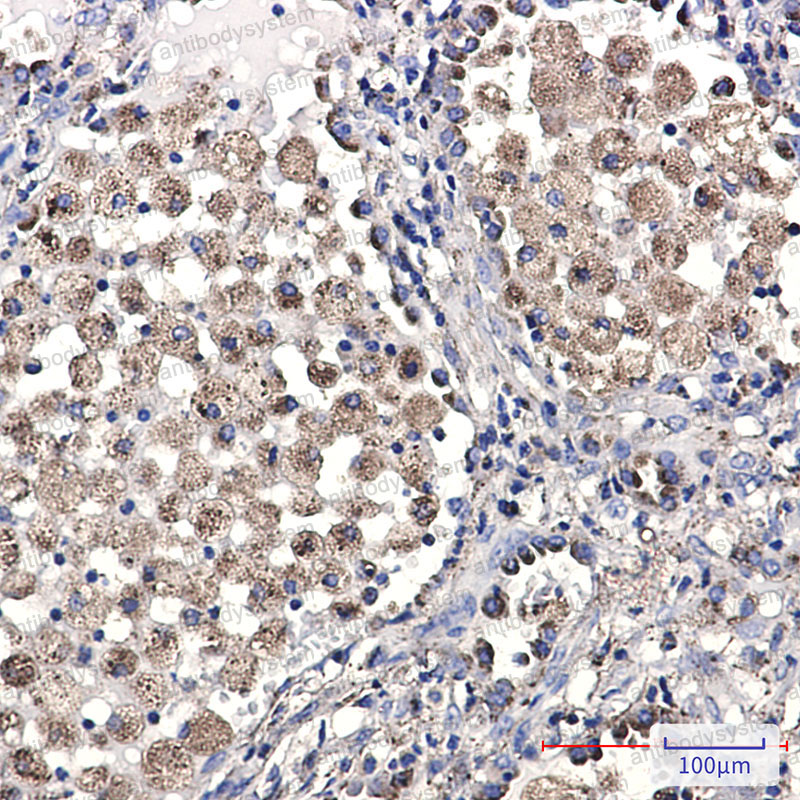 Валидация AntibodySystem RHC97401