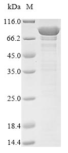 SDS-PAGE