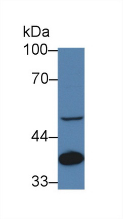 14231