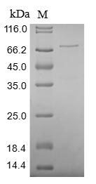 SDS-PAGE