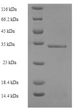 SDS-PAGE
