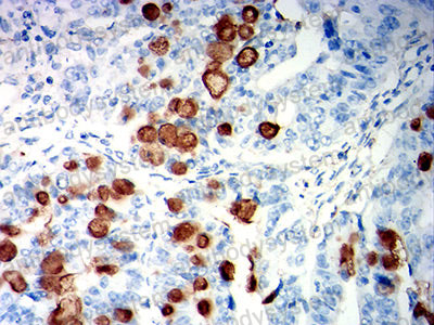 Валидация AntibodySystem RHF96004