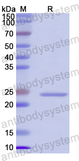 YWK12101, SDS-PAGE