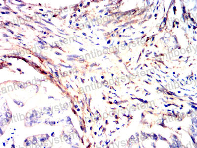 Валидация AntibodySystem RHB97507