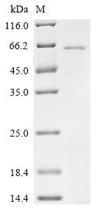 SDS-PAGE