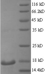 SDS-PAGE