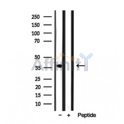 Валидация Affinity DF12010 - 6013