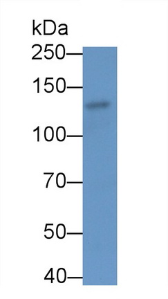 21795
