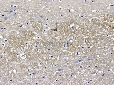 Валидация Affinity DF13282 - 8396