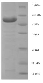 SDS-PAGE