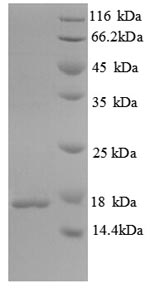SDS-PAGE