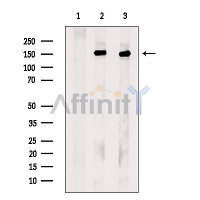 Валидация Affinity DF13467 - 8819