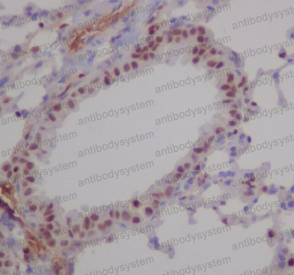 Валидация AntibodySystem RHF86101 (2709)
