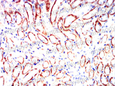 Валидация AntibodySystem RHG06501 (2820)