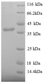 SDS-PAGE