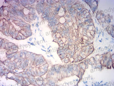 Валидация AntibodySystem RHC36009 (972)