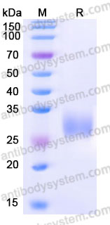AMA29101, SDS-PAGE