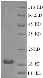 SDS-PAGE