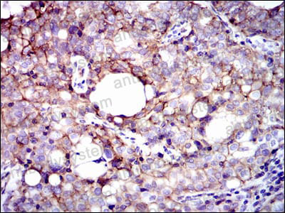 Валидация AntibodySystem RHC17603